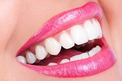 Photograph of close up smile, Teeth Whitening, Jamestown, NC